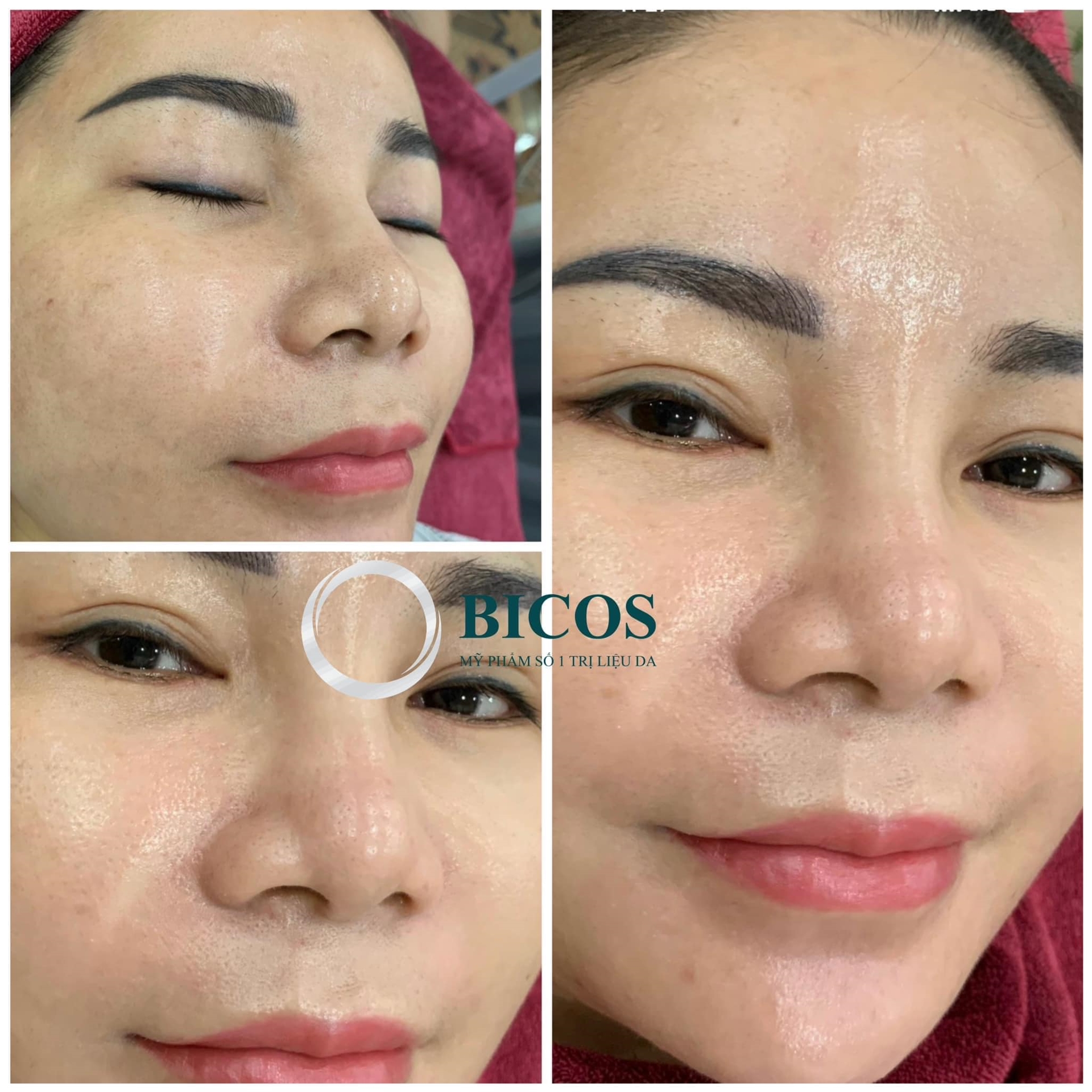 Dịch Vụ Căng Bóng Trắng Sáng Da