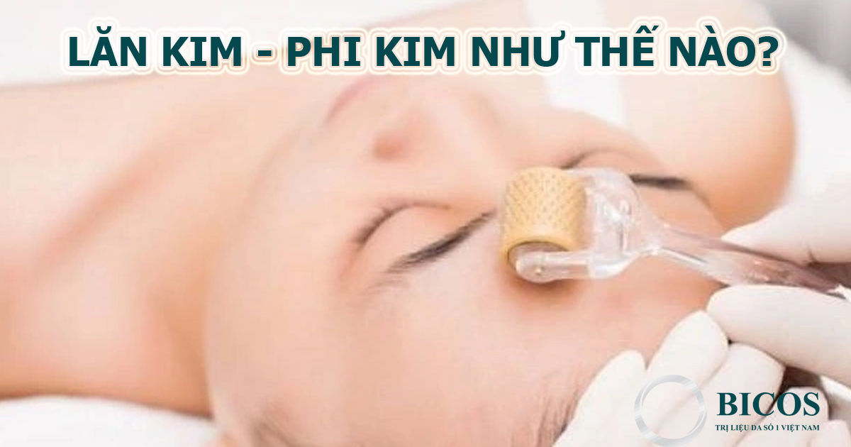 Phương Pháp Lăn Kim Hiện Đại Nhất Được Nhiều Người Ưa Chuộng